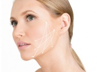 Аптос нити &#8212; эффективная технология подтяжки кожи лица и тела