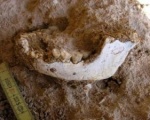 Раскопки рассказывают о стоматологии 6,5 тысяч лет назад