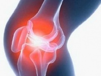 Лечение гемартроза коленного сустава